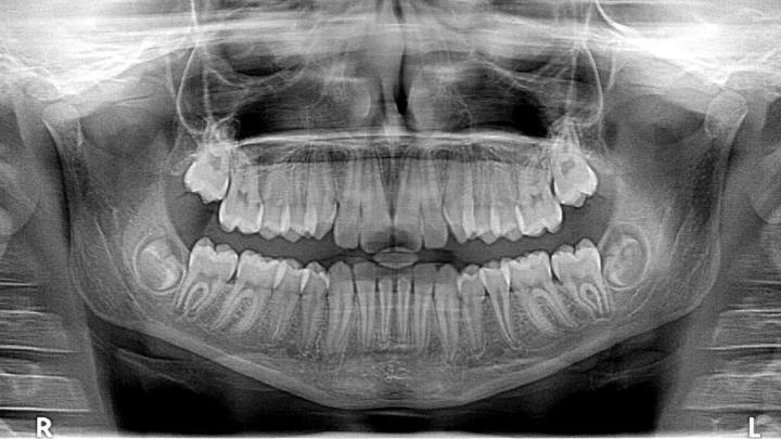 Почему к стоматологу-гнатологу